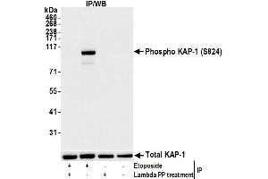 Immunoprecipitation (IP) image for anti-Tripartite Motif Containing 28 (TRIM28) (pSer824) antibody (ABIN7450388) (KAP1 anticorps  (pSer824))