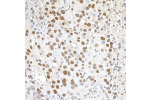 anti-Paf1, RNA Polymerase II Associated Factor, Homolog (PAF1) (AA 475-525) antibody