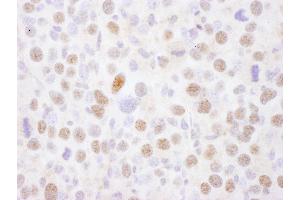 Immunohistochemistry (IHC) image for anti-Myocyte Enhancer Factor 2A (MEF2A) (AA 175-225) antibody (ABIN7454560)