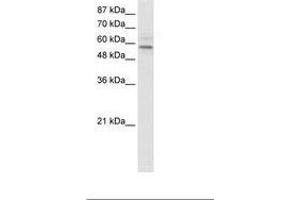 Image no. 1 for anti-Transmembrane Protein 175 (TMEM175) (AA 34-83) antibody (ABIN202675) (TMEM175 anticorps  (AA 34-83))