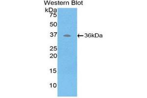 Western Blotting (WB) image for anti-ATPase, H+ Transporting, Lysosomal Accessory Protein 2 (ATP6AP2) (AA 17-302) antibody (ABIN3203347) (ATP6AP2 anticorps  (AA 17-302))