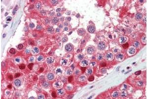 Testis, Human: Formalin-Fixed, Paraffin-Embedded (FFPE) (Ubiquitin anticorps)