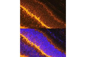 Immunofluorescence analysis of mouse retina using Synaptophysin Rabbit pAb (ABIN6135349, ABIN6148783, ABIN6148784 and ABIN6221958) at dilution of 1:100 (40x lens).