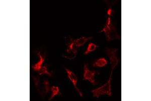 ABIN6274450 staining COLO205 cells by IF/ICC. (MADD anticorps  (Internal Region))