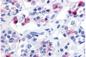 Human Anterior Pituitary (formalin-fixed, paraffin-embedded) stained with PRLHR antibody ABIN213447 at 20 ug/ml followed by biotinylated goat anti-rabbit IgG secondary antibody ABIN481713, alkaline phosphatase-streptavidin and chromogen.