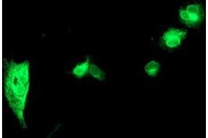 Image no. 2 for anti-serine Peptidase Inhibitor, Kunitz Type 1 (SPINT1) antibody (ABIN1501109)