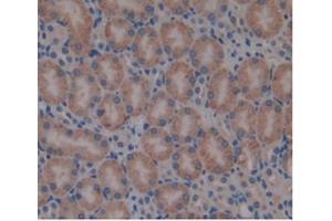 Detection of b2M in Mouse Kidney Tissue using Monoclonal Antibody to Beta-2-Microglobulin (b2M) (beta-2 Microglobulin anticorps  (AA 22-119))