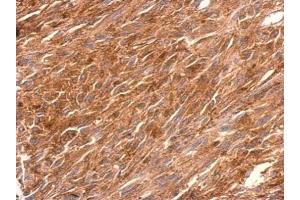 IHC-P Image PGCP antibody detects PGCP protein at cytosol on U373 xenograft by immunohistochemical analysis. (CPQ anticorps)
