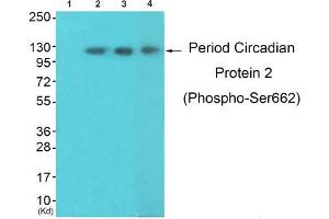 Western blot analysis of extracts from 3T3lbnotHeLa and K562 cells, using Period Circadian Protein 2 (Phospho-Ser662) Antibody.