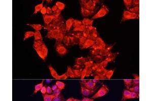 Immunofluorescence analysis of HeLa cells using AOC1 Polyclonal Antibody at dilution of 1:100 (40x lens).