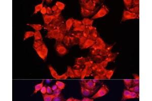 Immunofluorescence analysis of HeLa cells using AOC1 Polyclonal Antibody at dilution of 1:100 (40x lens). (DAO anticorps)