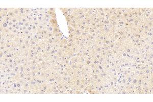 Detection of TREM1 in Mouse Liver Tissue using Polyclonal Antibody to Triggering Receptor Expressed On Myeloid Cells 1 (TREM1)