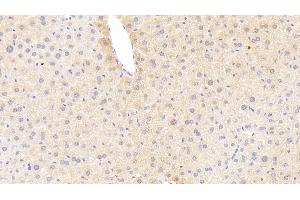 Detection of TREM1 in Mouse Liver Tissue using Polyclonal Antibody to Triggering Receptor Expressed On Myeloid Cells 1 (TREM1) (TREM1 anticorps  (AA 21-230))