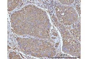 IHC analysis of OCRL using anti-OCRL antibody (ABIN7599572). (OCRL anticorps  (AA 1-901))