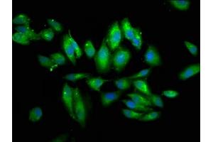 Immunofluorescence staining of Hela cells with ABIN7154344 at 1:66, counter-stained with DAPI.