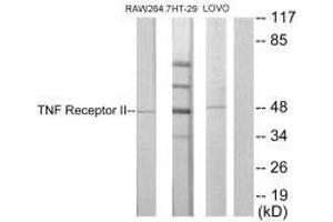Western blot analysis of extracts from RAW264. (TNFRSF1B anticorps  (C-Term))
