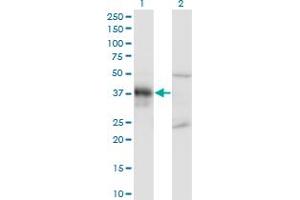 Western Blot analysis of DLX3 expression in transfected 293T cell line by DLX3 monoclonal antibody (M02), clone 3B8. (DLX3 anticorps  (AA 1-287))
