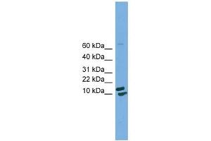 PPIH antibody used at 1 ug/ml to detect target protein. (PPIH anticorps)