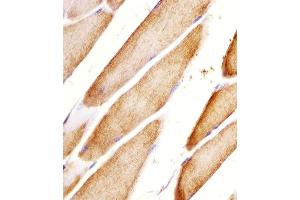 (ABIN6243464 and ABIN6578057) staining Htr2a in mouse skeletal muscle sections by Immunohistochemistry (IHC-P - paraformaldehyde-fixed, paraffin-embedded sections). (HTR2A anticorps  (N-Term))