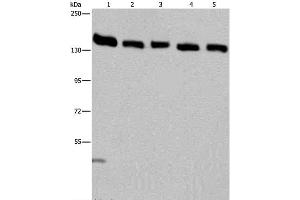 Western Blot analysis of Hela cell and Human testis tissue, A549, Jurkat and K562 cell using IPO4 Polyclonal Antibody at dilution of 1:550 (Importin 4 anticorps)