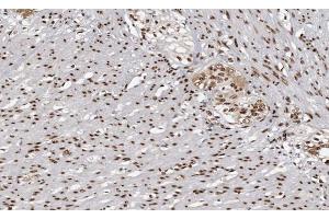 ABIN6266862 at 1/100 staining human Smooth muscle tissue sections by IHC-P. (MAPKAP Kinase 3 anticorps  (C-Term))