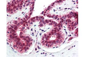 Anti-TNFRSF10A / DR4 antibody IHC of human breast. (TNFRSF10A anticorps  (AA 1-20))