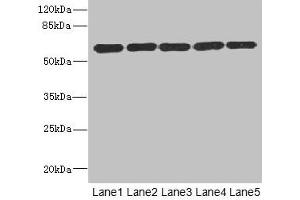 Western blot All lanes: ARHGEF3 antibody at 2. (ARHGEF3 anticorps  (AA 287-526))