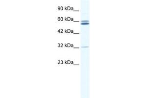 Western Blotting (WB) image for anti-Zinc Finger Protein 491 (ZNF491) antibody (ABIN2461306) (ZNF491 anticorps)
