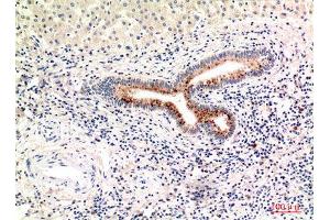Immunohistochemistry (IHC) analysis of paraffin-embedded Human Liver, antibody was diluted at 1:100. (Complement C4A/C4B (Internal Region) anticorps)