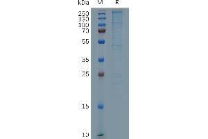 Human L Protein, His Tag on SDS-PAGE under reducing condition.