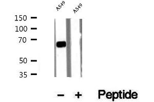 Western blot analysis of extracts of A549 cells, using Syndecan-3 antibody. (SDC3 anticorps)