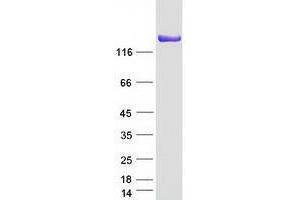 Validation with Western Blot