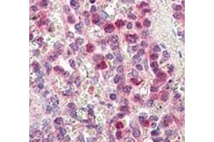 IHC analysis of FFPE human spleen tissue stained with MMP9 antibody