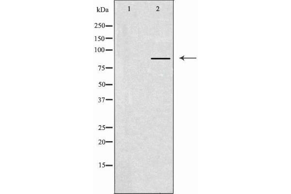 CLCN7 anticorps  (N-Term)