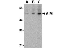 Image no. 1 for anti-CD5 Molecule-Like (CD5L) (C-Term) antibody (ABIN265124) (CD5L anticorps  (C-Term))