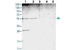 Western blot analysis of Lane 1: RT-4, Lane 2: U-251 MG, Lane 3: Human Plasma, Lane 4: Liver, Lane 5: Tonsil with TMEM180 polyclonal antibody  at 1:250-1:500 dilution. (TMEM180 anticorps)