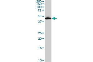 PDK2 monoclonal antibody (M02), clone 5F8. (PDK2 anticorps  (AA 187-276))