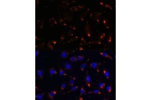 Immunofluorescence analysis of L929 cells using NOS1 antibody (ABIN6129512, ABIN6144725, ABIN6144726 and ABIN6216548) at dilution of 1:100.