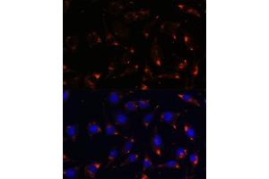 Immunofluorescence analysis of L929 cells using NOS1 antibody (ABIN6129512, ABIN6144725, ABIN6144726 and ABIN6216548) at dilution of 1:100. (NOS1 anticorps  (AA 1-180))