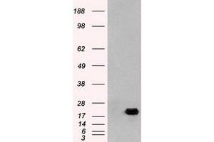 Image no. 1 for anti-Adenylate Kinase 1 (AK1) antibody (ABIN1496516) (Adenylate Kinase 1 anticorps)