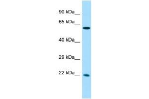 Host: Rabbit Target Name: CCDC85A Sample Type: Fetal Liver lysates Antibody Dilution: 1. (CCDC85A anticorps  (N-Term))