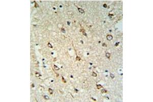 Formalin fixed and paraffin embedded human brain tissue reacted with DNAJC6 Antibody  followed by peroxidase conjugation of the secondary antibody and DAB staining.