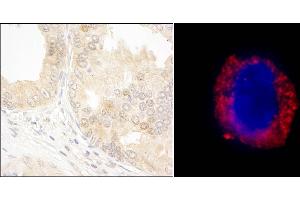 Immunohistochemistry (IHC) image for anti-C-Abl Oncogene 1, Non-Receptor tyrosine Kinase (ABL1) (AA 550-600) antibody (ABIN7455216)
