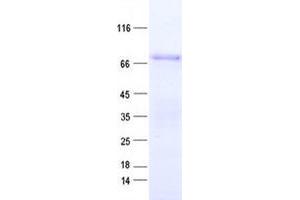 Validation with Western Blot
