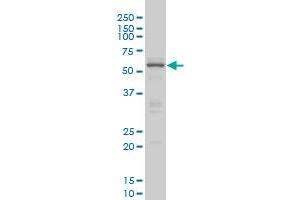 Western Blotting (WB) image for anti-CAMP Responsive Element Binding Protein 5 (CREB5) (AA 1-100) antibody (ABIN599087) (CREB5 anticorps  (AA 1-100))