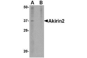 Western blot analysis of Akirin2 in mouse brain tissue lysate with AP30040PU-N Akirin2 antibody at 1 μg/ml in (A) the absence and (B) the presence of blocking peptide. (AKIRIN2 anticorps  (Center))