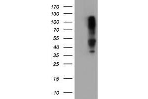 Image no. 1 for anti-serpin Peptidase Inhibitor, Clade B (Ovalbumin), Member 1 (SERPINB1) (AA 77-306) antibody (ABIN1491672) (SERPINB1 anticorps  (AA 77-306))