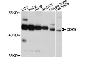 Western blot analysis of extracts of various cell lines, using CDK9 antibody. (CDK9 anticorps)