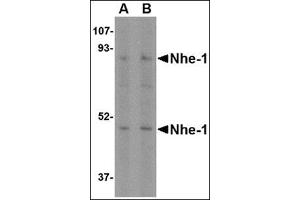 Western blot analysis of Nhe-1 in MOLT4 cell lysate with this product at (A) 1 and (B) 2 μg/ml. (SLC9A1 anticorps  (Center))