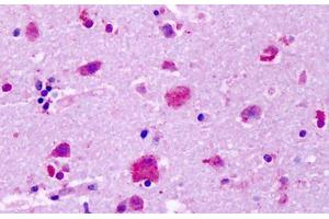 Anti-GPR83 antibody IHC staining of human brain, cortex, neurons.